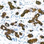 Cytokeratin 7 Antibody in Immunohistochemistry (Paraffin) (IHC (P))