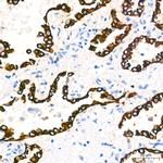 Cytokeratin 7 Antibody in Immunohistochemistry (Paraffin) (IHC (P))
