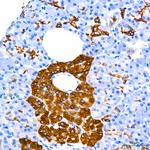 Cytokeratin 7 Recombinant Rabbit Monoclonal Antibody (6Q1B4)