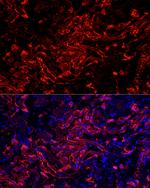 Cytokeratin 7 Antibody in Immunohistochemistry (Paraffin) (IHC (P))