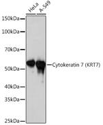 Cytokeratin 7 Antibody in Western Blot (WB)