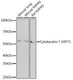Cytokeratin 7 Antibody in Western Blot (WB)