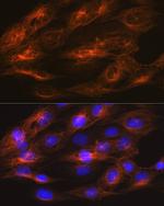beta Tubulin 2 Antibody in Immunocytochemistry (ICC/IF)