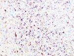 beta Tubulin 2 Antibody in Immunohistochemistry (Paraffin) (IHC (P))