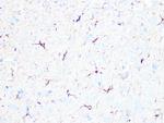 beta Tubulin 2 Antibody in Immunohistochemistry (Paraffin) (IHC (P))