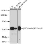 beta Tubulin 2 Antibody in Western Blot (WB)
