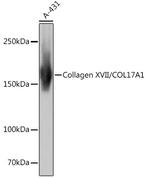 COL17A1 Antibody in Western Blot (WB)