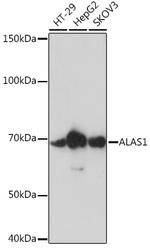 ALAS1 Recombinant Rabbit Monoclonal Antibody (2K1G3)