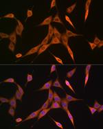 RhoA/RhoB/RhoC Recombinant Rabbit Monoclonal Antibody (7X5I9)