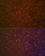 BDNF Antibody in Immunohistochemistry (Paraffin) (IHC (P))