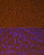 Calmodulin Recombinant Rabbit Monoclonal Antibody (10W3Y7)