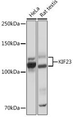 KIF23 Recombinant Rabbit Monoclonal Antibody (9V4Y8)