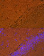 Synuclein alpha/beta Recombinant Rabbit Monoclonal Antibody (9E9X5)