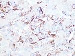 Cathepsin H/K/L/V Recombinant Rabbit Monoclonal Antibody (2Q10F10)