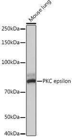 PKC epsilon Recombinant Rabbit Monoclonal Antibody (8I8K4)