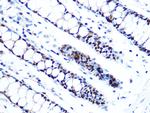 MCM5 Recombinant Rabbit Monoclonal Antibody (4P1Q5)