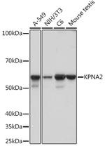 KPNA2 Recombinant Rabbit Monoclonal Antibody (9T3V8)