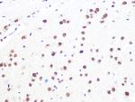 DDB1 Antibody in Immunohistochemistry (Paraffin) (IHC (P))