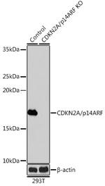 p14ARF Antibody in Western Blot (WB)