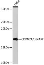p14ARF Antibody in Western Blot (WB)