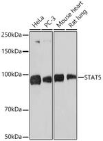 STAT5 alpha/beta Recombinant Rabbit Monoclonal Antibody (3J2A2)