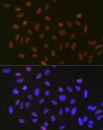 SUMO2/SUMO3 Recombinant Rabbit Monoclonal Antibody (6R8G7)
