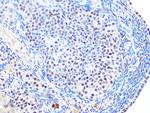 SUMO2/SUMO3 Antibody in Immunohistochemistry (Paraffin) (IHC (P))