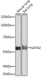 GATA2/GATA3 Recombinant Rabbit Monoclonal Antibody (1K8H6)