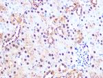 PSMA3 Recombinant Rabbit Monoclonal Antibody (7X8W9)