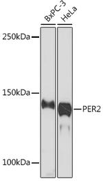 PER2 Recombinant Rabbit Monoclonal Antibody (2K9Y0)
