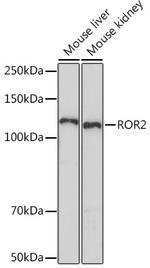 ROR2 Recombinant Rabbit Monoclonal Antibody (0B7X8)