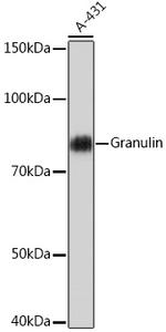 Granulins Antibody in Western Blot (WB)