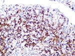 LDHB Antibody in Immunohistochemistry (Paraffin) (IHC (P))