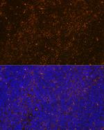 WASP Antibody in Immunohistochemistry (Paraffin) (IHC (P))