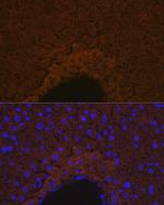 Apolipoprotein M Antibody in Immunohistochemistry (Paraffin) (IHC (P))