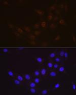RAD23A Recombinant Rabbit Monoclonal Antibody (3B7T9)