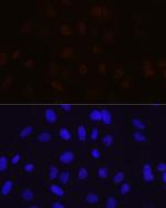 MBNL1 Recombinant Rabbit Monoclonal Antibody (7N6W3)