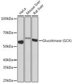 GCK Recombinant Rabbit Monoclonal Antibody (4K9D5)
