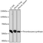 Thromboxane synthase Recombinant Rabbit Monoclonal Antibody (6B7Z7)