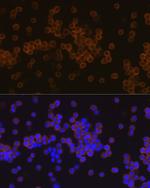 PLCG2 Recombinant Rabbit Monoclonal Antibody (7I1C9)