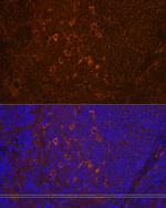 PLCG2 Antibody in Immunohistochemistry (Paraffin) (IHC (P))