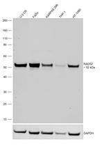 RAD52 Recombinant Rabbit Monoclonal Antibody (7H5K0)