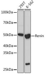 Renin Recombinant Rabbit Monoclonal Antibody (1L1B7)