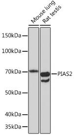 PIAS2 Recombinant Rabbit Monoclonal Antibody (4I6K6)