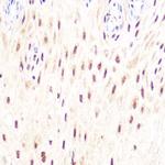 DP1 Recombinant Rabbit Monoclonal Antibody (8C0O3)