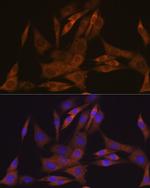KAP3 Recombinant Rabbit Monoclonal Antibody (1S7J7)
