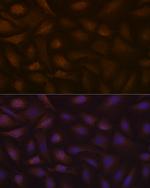 KAP3 Antibody in Immunocytochemistry (ICC/IF)
