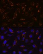 DLD Antibody in Immunocytochemistry (ICC/IF)