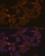 Desmoglein 3 Recombinant Rabbit Monoclonal Antibody (1T1D5)