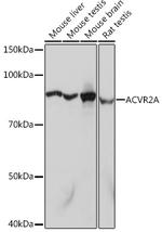 ACVR2A Recombinant Rabbit Monoclonal Antibody (1K1J10)